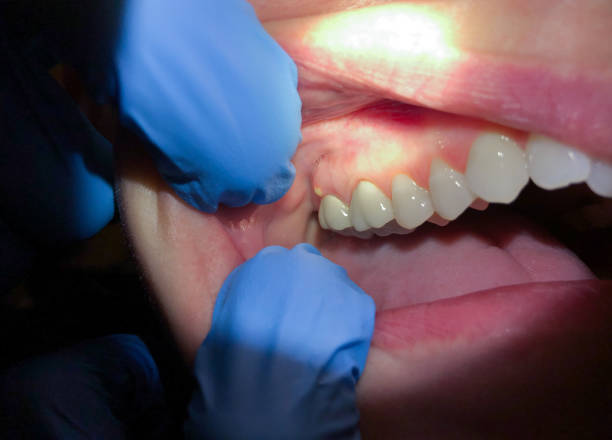 Best Emergency Dental Care for Trauma or Injury in Dodge City, KS